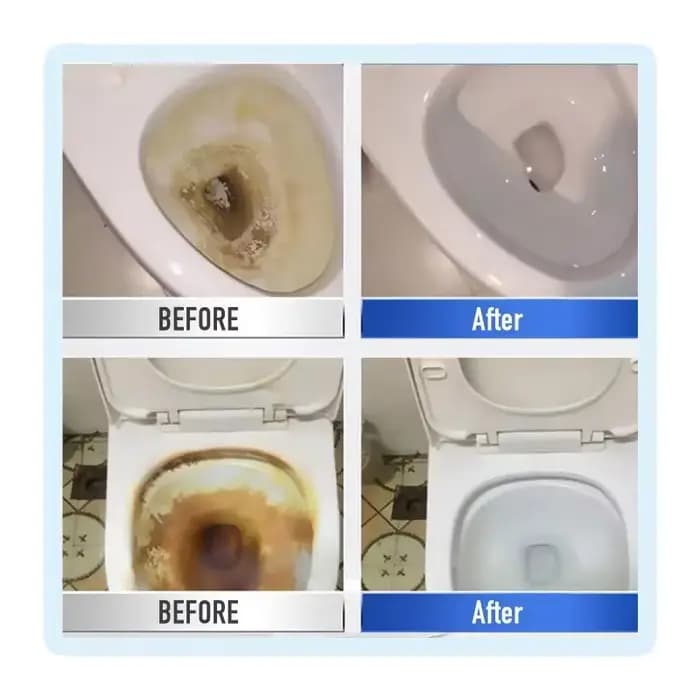  Nettoyeur de toilettes magnétique